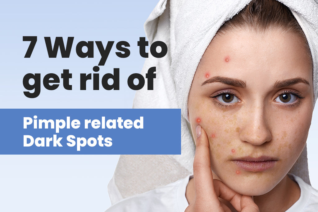 7 Ways to get rid of Pimple related Dark spots